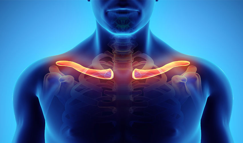 China 3D Prints First PEEK Clavicle Implant