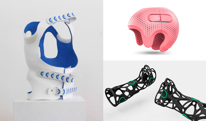 Top 3D Printed Orthoses