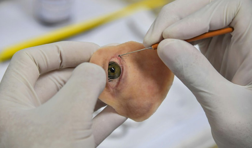 Making a facial prosthesis on photogrammetry software