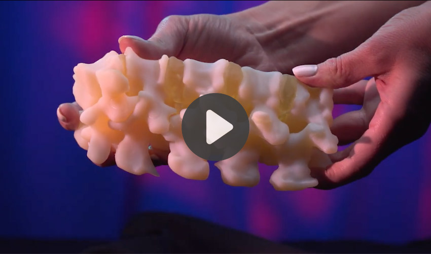 Top 5 Videos of the Week: 3D printing realistic medial models