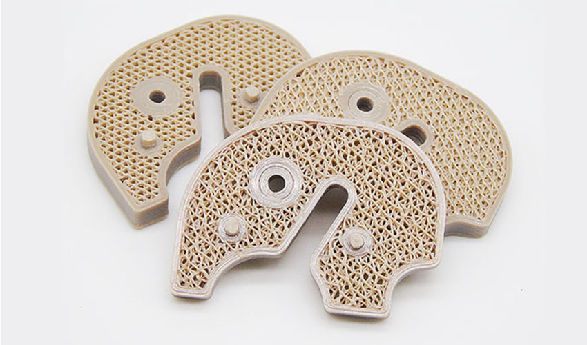 3D printed porous scaffold structures can promote bone growth in patients