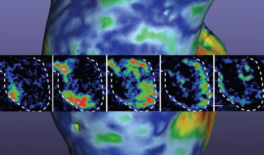 Researchers 3D print functioning human heart pump