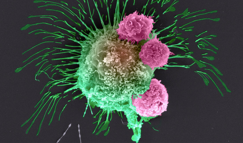 Researchers 3D print fish-gelatin patches for cancer treatment