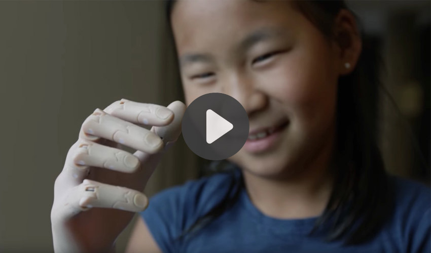 Top 5 Videos: 3D printing prosthetic arms, and more