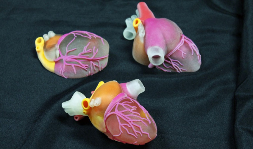 New study shows growth in the 3D printed surgical model market