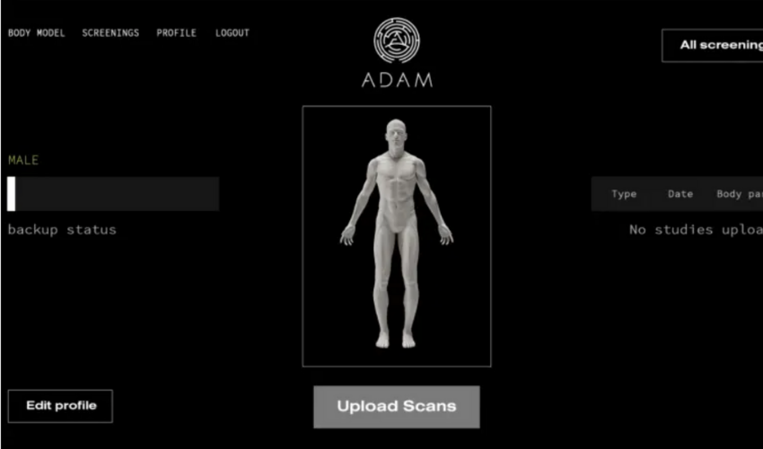A.D.A.M project develops 3D printed personalizable bone implants platform
