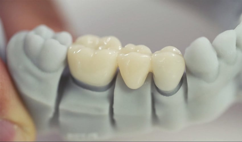 Are the resins used in dental 3D printing dangerous for reproductive health?