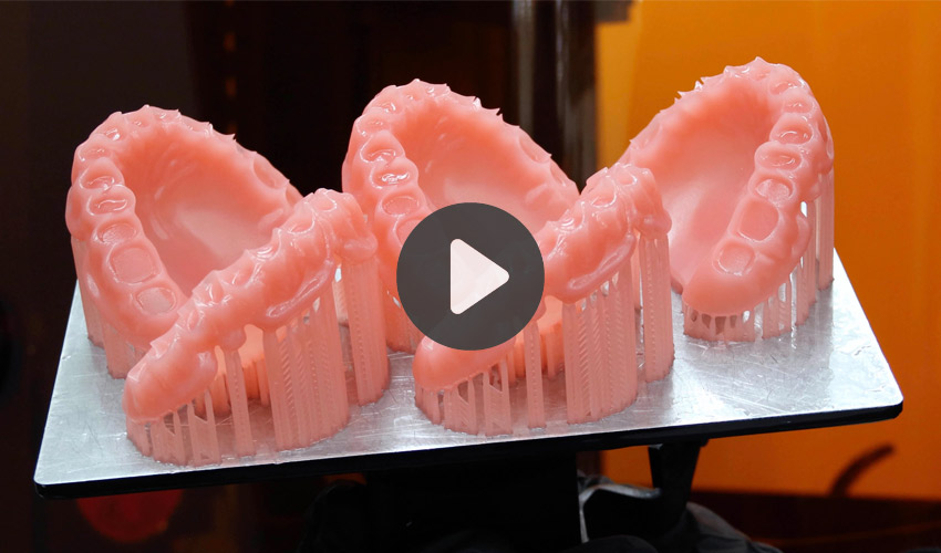 TOP 5 Videos: How to Print and Post-Process Dental Models