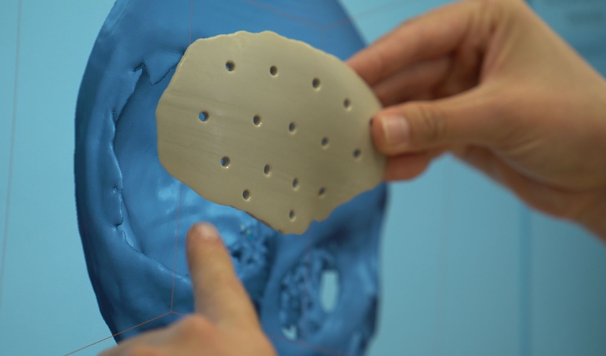 Kumovis on Decentralizing Production of Plastic Medical Devices and Implants