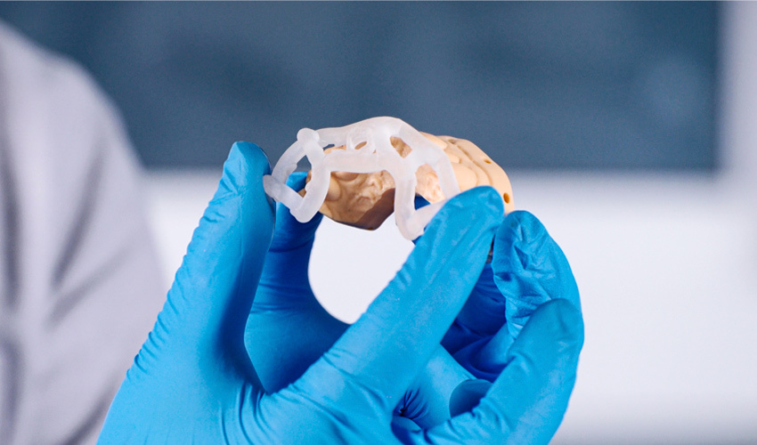 Resin 3D Printing in Dentistry for Precise Surgical Guides and Dental Implants