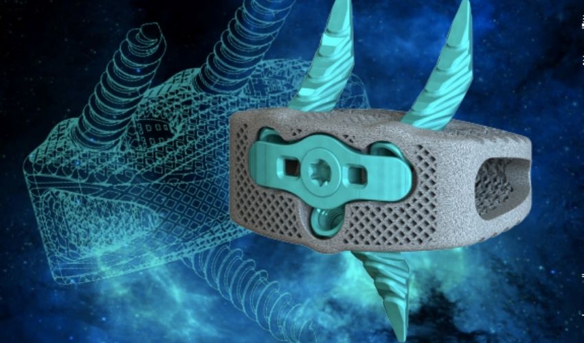 Osseus Announces FDA510 clearance Of New Pisces-SA ALIF System