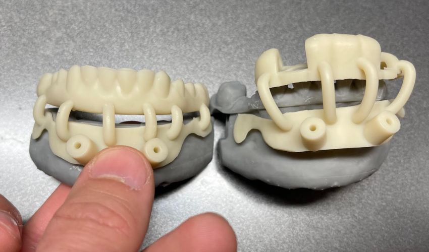 Navy Sailors Receive 3D Printed Dental Prosthetics