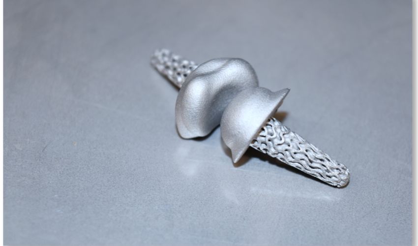 3D Printed Finger Implants Could Revolutionize Rheumatic Disorder Treatment