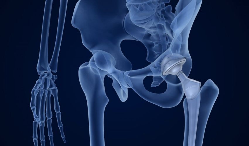 3D Printed Antibacterial Scaffolds for Bone Regeneration