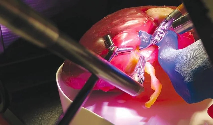 3D Printing Allowed One Youtuber to Perform Surgery on His Own Organs in Real Time