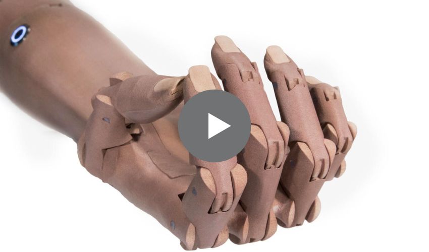 Top 5 Videos: Unlimited Tomorrow’s Prosthetic Arms for Ukraine