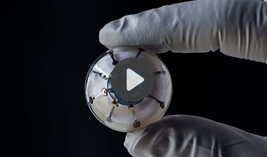 Top 5 Videos: Revolutionary 3D Printing Technology Transforms Artificial Eyes for Patients