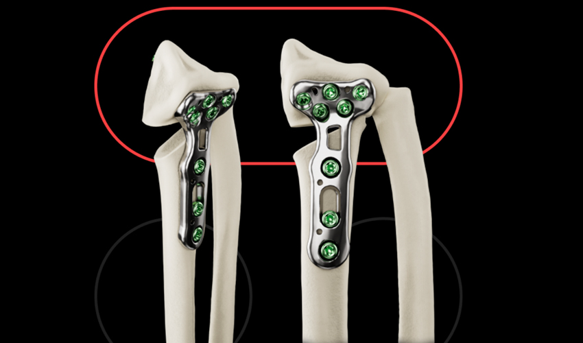 Tailor Surgery on the Use of Additive Manufacturing in Medicine
