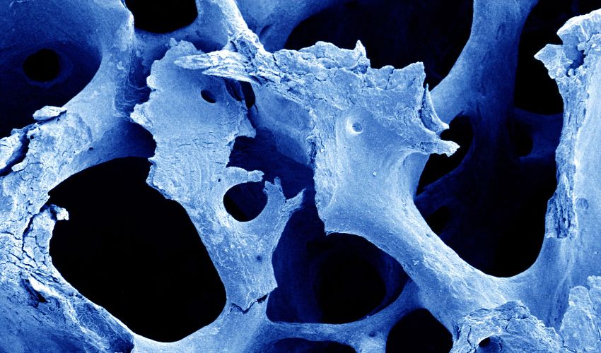 Smart Scaffolds for Strong Bones: The Potential of 3D/4D Bio-Piezoelectric Printing