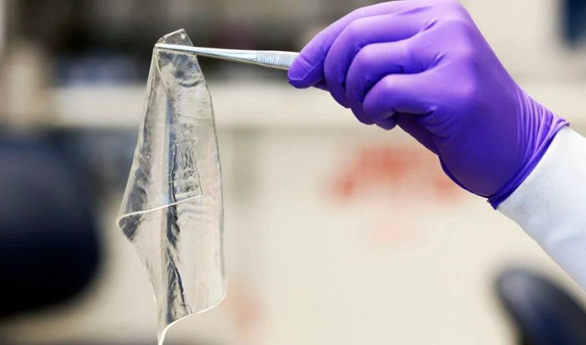 Breakthrough In Diabetic Foot Ulcer Treatment With 3D Printed Wound Dressings