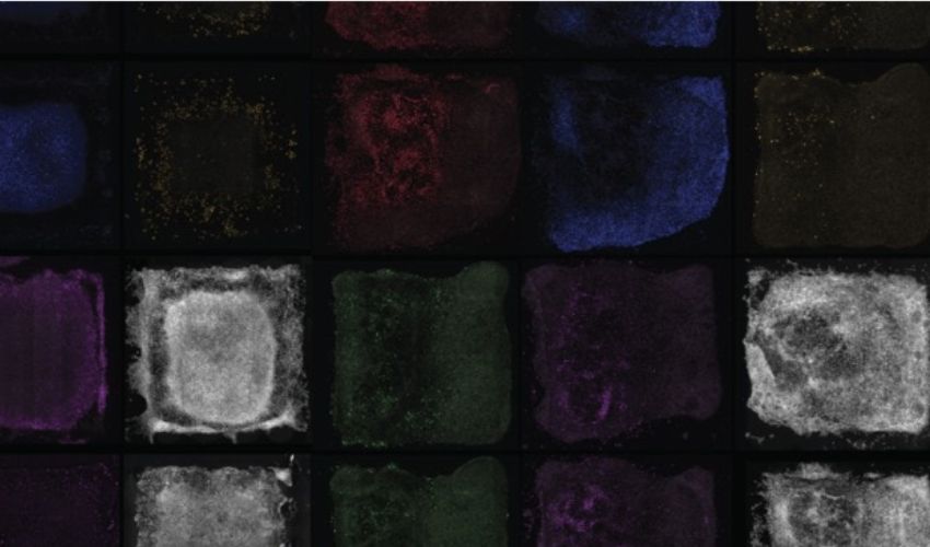 The University of Sydney Takes a Leap Towards Functional 3D Printed Human Tissues