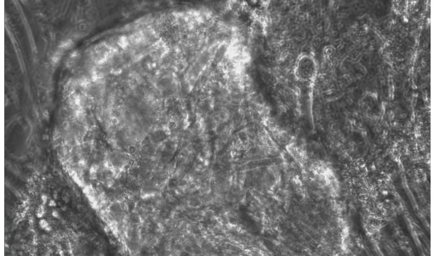 Researchers Successfully 3D Print Muscle Tissues