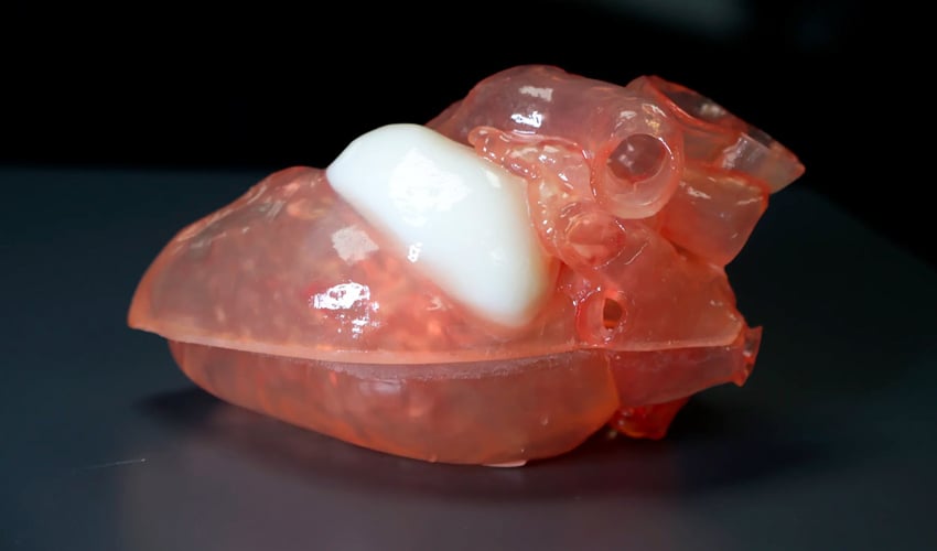 Medical 3D Printing Expands in the American Midwest