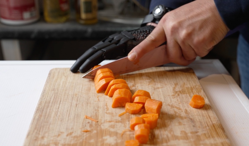 3D printed hand from Open Bionics