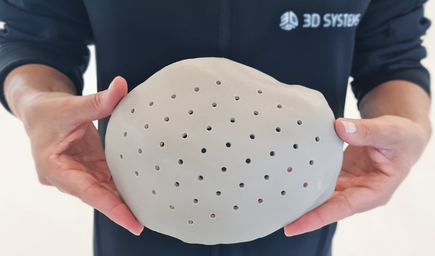 3D Systems Receives FDA Clearance for 3D Printed VSP PEEK Cranial Implants