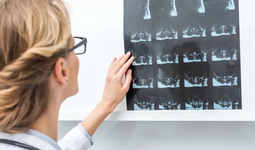 A 3D Printed Zinc Scaffold Could Treat Bone Defects