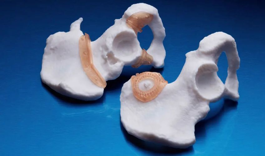 Ricoh and Insight Surgery's Surgical Guide