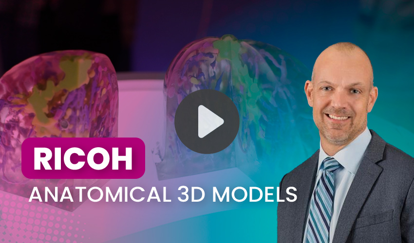 3D printed surgical guides for breast cancer treatment
