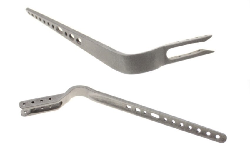 Application of the Month: Customized 3D-Printed Titanium Shoulder Arthrodesis Plates