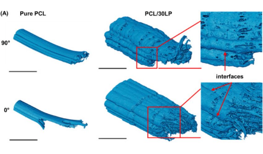 bioactive bone implants