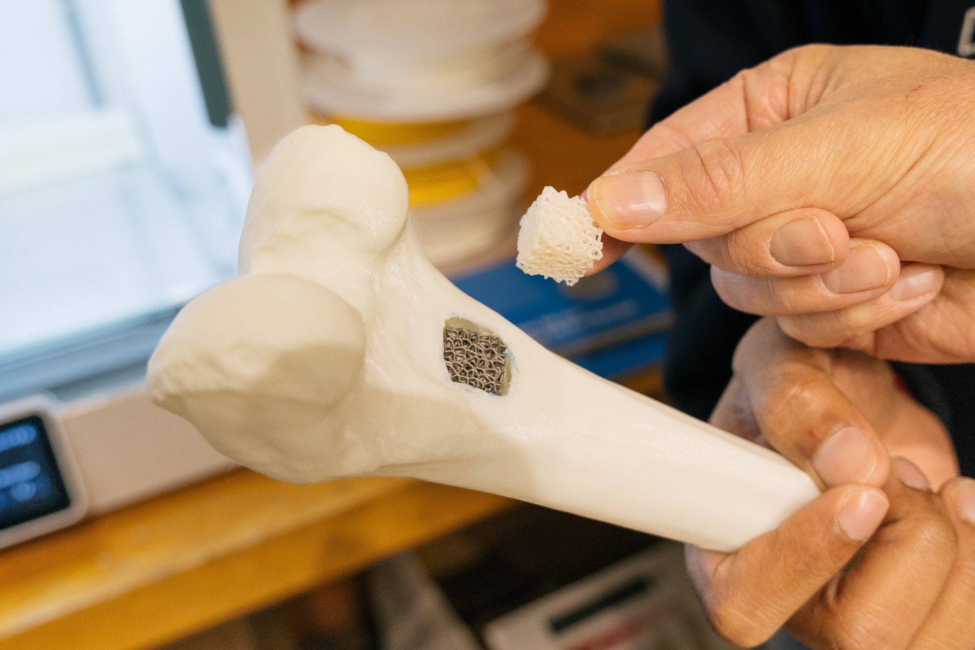 3D printed bone scaffolds