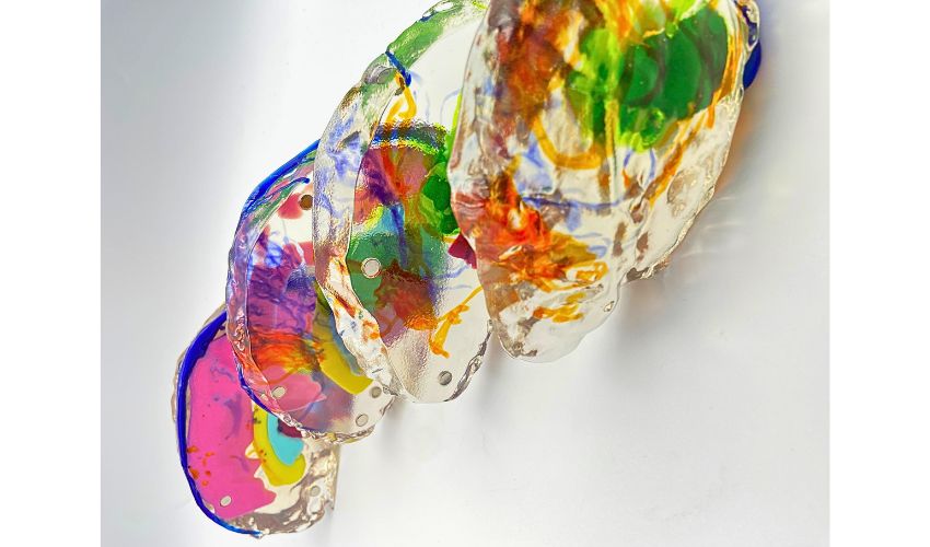 3D printed brain model for surgical planning