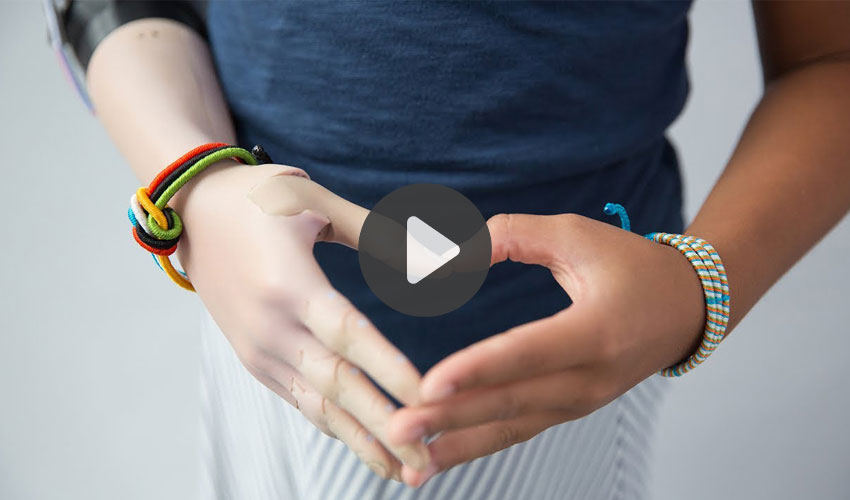 TOP 5 Videos of the Week: 3D Printing in Medicine and more !