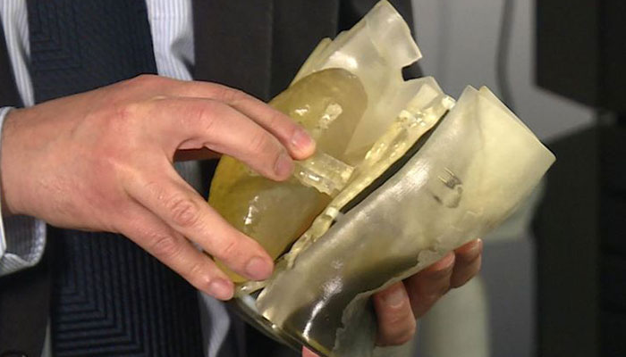 3D printing surgery