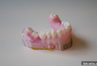 Bone3D Transforming Surgery with 3D Printing