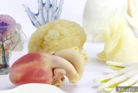 Surgical Planning Reimagined: The Power of 3D Printed Anatomy
