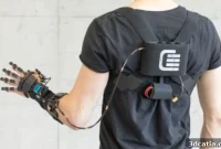 Precision Recovery: 3D Printed Exoskeletons in Rehabilitation