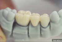 Reproductive Toxicity Profile of Dental 3D Printing Resins