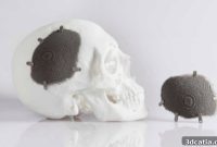 The Rise of 3D Printed Implants