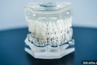 LightForce Fuels 3D Orthodontics Revolution with $50M Investment