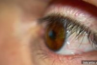 British Patient Fitted With World’s First 3D-Printed Eye