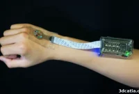 3D Printing Transforms Lupus Treatment