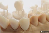 3D Printing: A Technical Game Changer for Dentistry
