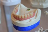 Revolutionizing Dentures: Quality and Affordability with 3D Printing