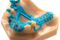 Structo and Materialise Power the Future of Dental 3D Printing with PrintWorks Pro