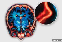 Bitmap Printing and Unlikely Alliance: A Game-Changer for Pediatric Epilepsy Surgery
